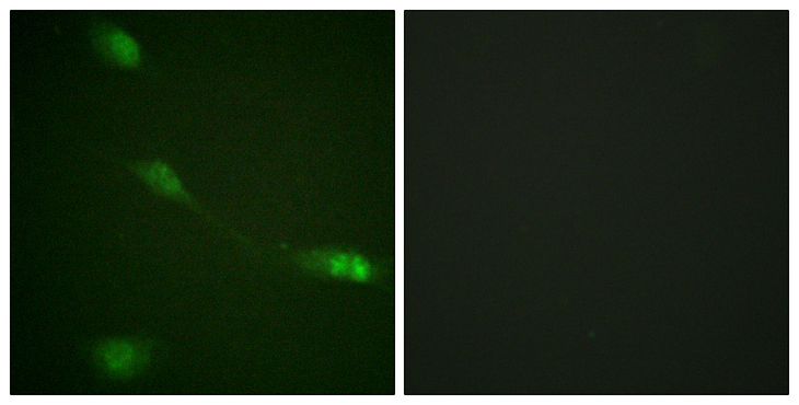 MDM2 Antibody - Immunofluorescence analysis of NIH/3T3 cells, using MDM2 Antibody. The picture on the right is blocked with the synthesized peptide.