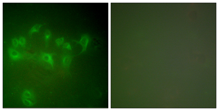 MDM2 Antibody - Immunofluorescence analysis of A549 cells, using MDM2 Antibody. The picture on the right is blocked with the synthesized peptide.