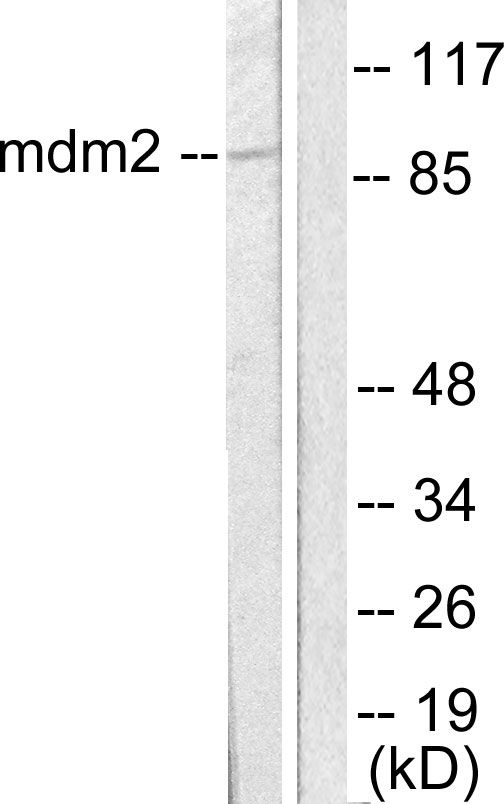 MDM2 Antibody - Western blot analysis of lysates from SKOV3 cells, using MDM2 Antibody. The lane on the right is blocked with the synthesized peptide.