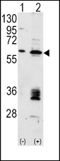MDM2 Antibody - Western blot of MDM2 (arrow) using rabbit polyclonal Mdm2 Antibody. 293 cell lysates (2 ug/lane) either nontransfected (Lane 1) or transiently transfected with the MDM2 gene (Lane 2) (Origene Technologies).
