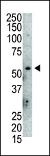 MDM2 Antibody - Western blot of anti-Mdm2 antibody in mouse lung tissue lysate. Mdm2 (Arrow) was detected using purified antibody. Secondary HRP-anti-rabbit was used for signal visualization with chemiluminescence.