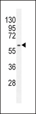 MDM2 Antibody - MDM2 Antibody (Q213) western blot of HepG2 cell line lysates (35 ug/lane). The MDM2 antibody detected the MDM2 protein (arrow).