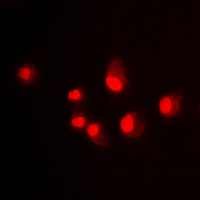 MDM2 Antibody - Immunofluorescent analysis of MDM2 staining in Jurkat cells. Formalin-fixed cells were permeabilized with 0.1% Triton X-100 in TBS for 5-10 minutes and blocked with 3% BSA-PBS for 30 minutes at room temperature. Cells were probed with the primary antibody in 3% BSA-PBS and incubated overnight at 4 C in a humidified chamber. Cells were washed with PBST and incubated with a DyLight 594-conjugated secondary antibody (red) in PBS at room temperature in the dark. DAPI was used to stain the cell nuclei (blue).