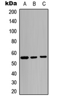 MDM2 Antibody - Western blot analysis of MDM2 expression in A549 (A); mouse liver (B); rat lung (C) whole cell lysates.