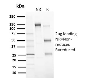 MDM2 Antibody - SDS-PAGE analysis of purified, BSA-free MDM2 antibody (clone MDM2/2414) as confirmation of integrity and purity.
