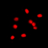 MDM2 Antibody - Immunofluorescent analysis of MDM2 staining in NIH3T3 cells. Formalin-fixed cells were permeabilized with 0.1% Triton X-100 in TBS for 5-10 minutes and blocked with 3% BSA-PBS for 30 minutes at room temperature. Cells were probed with the primary antibody in 3% BSA-PBS and incubated overnight at 4 deg C in a humidified chamber. Cells were washed with PBST and incubated with a DyLight 594-conjugated secondary antibody (red) in PBS at room temperature in the dark. DAPI was used to stain the cell nuclei (blue).