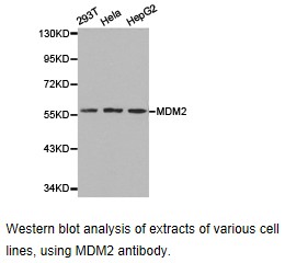 MDM2 Antibody - Western blot.
