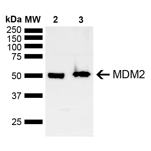 MDM2 Antibody - Western blot analysis of Mouse, Rat Brain showing detection of ~40 kDa MDM2 protein using Rabbit Anti-MDM2 Polyclonal Antibody. Lane 1: Molecular Weight Ladder (MW). Lane 2: Mouse Brain. Lane 3: Rat Brain. Load: 15 µg. Block: 5% Skim Milk in 1X TBST. Primary Antibody: Rabbit Anti-MDM2 Polyclonal Antibody  at 1:1000 for 2 hours at RT. Secondary Antibody: Goat Anti-Rabbit IgG: HRP at 1:5000 for 1 hour at RT. Color Development: ECL solution for 5 min at RT. Predicted/Observed Size: ~40 kDa. Other Band(s): Isoform 2 or 3.