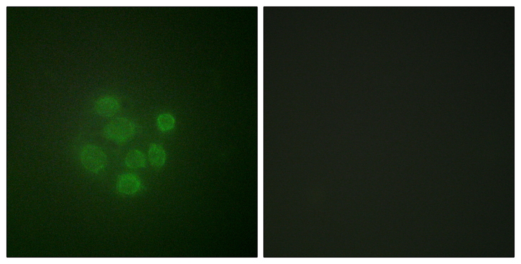 MDM2 Antibody - Immunofluorescence analysis of A549 cells, using MDM2 (Phospho-Ser166) Antibody. The picture on the right is blocked with the phospho peptide.