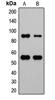 MDM2 Antibody - Western blot analysis of MDM2 (pS166) expression in HEK293T hydroxyurea-treated (A); MCF7 IGF-treated (B) whole cell lysates.