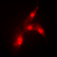 MDM2 Antibody - Immunofluorescent analysis of MDM2 (pS166) staining in MCF7 cells. Formalin-fixed cells were permeabilized with 0.1% Triton X-100 in TBS for 5-10 minutes and blocked with 3% BSA-PBS for 30 minutes at room temperature. Cells were probed with the primary antibody in 3% BSA-PBS and incubated overnight at 4 C in a humidified chamber. Cells were washed with PBST and incubated with a DyLight 594-conjugated secondary antibody (red) in PBS at room temperature in the dark. DAPI was used to stain the cell nuclei (blue).