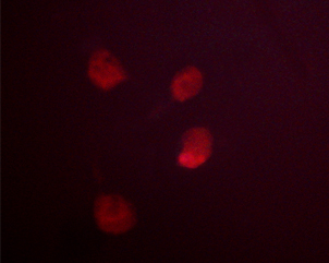 MDM2 Antibody - Staining COS cells by IF/ICC. The samples were fixed with PFA and permeabilized in 0.1% saponin prior to blocking in 10% serum for 45 min at 37°C. The primary antibody was diluted 1/400 and incubated with the sample for 1 hour at 37°C. A Alexa Fluor 594 conjugated goat polyclonal to rabbit IgG (H+L), diluted 1/600 was used as secondary antibody.