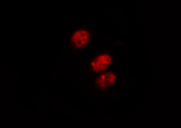 MDM2 Antibody - Staining COS7 cells by IF/ICC. The samples were fixed with PFA and permeabilized in 0.1% Triton X-100, then blocked in 10% serum for 45 min at 25°C. The primary antibody was diluted at 1:200 and incubated with the sample for 1 hour at 37°C. An Alexa Fluor 594 conjugated goat anti-rabbit IgG (H+L) Ab, diluted at 1/600, was used as the secondary antibody.