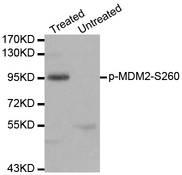MDM2 Antibody - Western blot analysis of extracts of 293 cells.