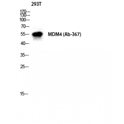 MDM4 / MDMX Antibody - Western blot of MDMX antibody