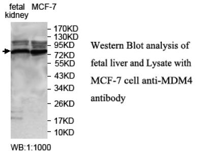 Anti-MDM4 / MDMX Antibody | Rabbit anti-Human Polyclonal | LSBio