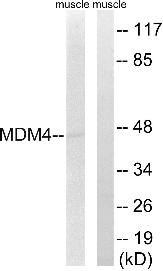 MDM4 / MDMX Antibody - Western blot analysis of lysates from rat muscle cells, using MDM4 Antibody. The lane on the right is blocked with the synthesized peptide.