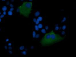 MDM4 / MDMX Antibody - Anti-MDM4 mouse monoclonal antibody immunofluorescent staining of COS7 cells transiently transfected by pCMV6-ENTRY MDM4.