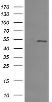 MDM4 / MDMX Antibody - HEK293T cells were transfected with the pCMV6-ENTRY control (Left lane) or pCMV6-ENTRY MDM4 (Right lane) cDNA for 48 hrs and lysed. Equivalent amounts of cell lysates (5 ug per lane) were separated by SDS-PAGE and immunoblotted with anti-MDM4.