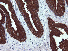 MDM4 / MDMX Antibody - IHC of paraffin-embedded Human prostate tissue using anti-MDM4 mouse monoclonal antibody. (Heat-induced epitope retrieval by 10mM citric buffer, pH6.0, 120°C for 3min).