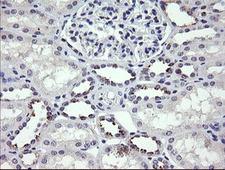 MDM4 / MDMX Antibody - IHC of paraffin-embedded Human Kidney tissue using anti-MDM4 mouse monoclonal antibody.