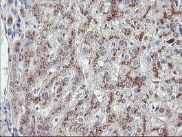 MDM4 / MDMX Antibody - IHC of paraffin-embedded Human liver tissue using anti-MDM4 mouse monoclonal antibody.