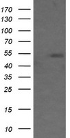 MDM4 / MDMX Antibody - HEK293T cells were transfected with the pCMV6-ENTRY control (Left lane) or pCMV6-ENTRY MDM4 (Right lane) cDNA for 48 hrs and lysed. Equivalent amounts of cell lysates (5 ug per lane) were separated by SDS-PAGE and immunoblotted with anti-MDM4.
