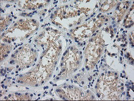 MDM4 / MDMX Antibody - IHC of paraffin-embedded Human Kidney tissue using anti-MDM4 mouse monoclonal antibody.