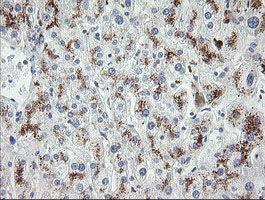 MDM4 / MDMX Antibody - IHC of paraffin-embedded Human liver tissue using anti-MDM4 mouse monoclonal antibody.