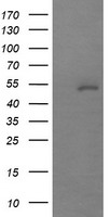 MDM4 / MDMX Antibody - HEK293T cells were transfected with the pCMV6-ENTRY control (Left lane) or pCMV6-ENTRY MDM4 (Right lane) cDNA for 48 hrs and lysed. Equivalent amounts of cell lysates (5 ug per lane) were separated by SDS-PAGE and immunoblotted with anti-MDM4.