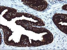 MDM4 / MDMX Antibody - IHC of paraffin-embedded Human prostate tissue using anti-MDM4 mouse monoclonal antibody. (Heat-induced epitope retrieval by 10mM citric buffer, pH6.0, 120°C for 3min).
