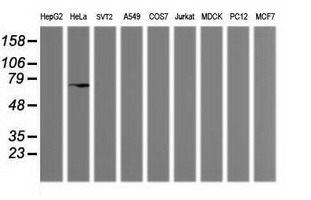 MDM4 / MDMX Antibody - Western blot of extracts (35 ug) from 9 different cell lines by using g anti-MDM4 monoclonal antibody (HepG2: human; HeLa: human; SVT2: mouse; A549: human; COS7: monkey; Jurkat: human; MDCK: canine; PC12: rat; MCF7: human).