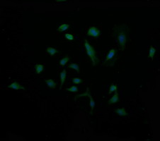 MDM4 / MDMX Antibody - Immunofluorescent staining of HeLa cells using anti-MDM4 mouse monoclonal antibody.