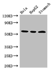 MDM4 / MDMX Antibody - Positive WB detected in:Hela whole cell lysate,HepG2 whole cell lysate,Mouse stomach tissue;All lanes: MDM4 antibody at 3ug/ml;Secondary;Goat polyclonal to rabbit IgG at 1/50000 dilution;Predicted band size: 55,15,14,19,50 kDa;Observed band size: 55 kDa;