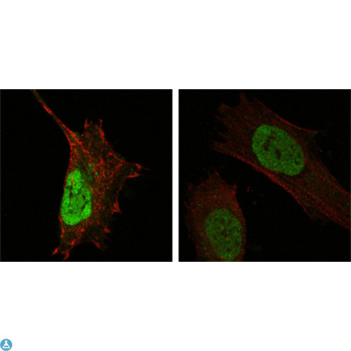 MDM4 / MDMX Antibody - Confocal Immunofluorescence (IF) analysis of HeLa (left) and L-02 (right) cells using MDMX Monoclonal Antibody (green). Red: Actin filaments have been labeled with DY-554 phalloidin.