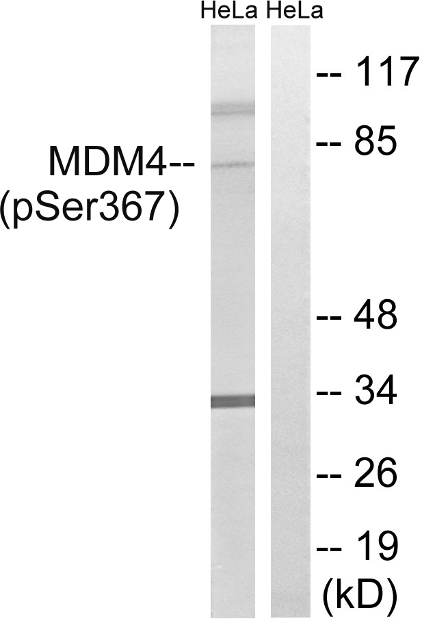MDM4 / MDMX Antibody - Western blot analysis of lysates from HeLa cells treated with calyculinA 50ng/ml 30', using MDM4 (Phospho-Ser367) Antibody. The lane on the right is blocked with the phospho peptide.