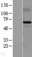 MDM4 / MDMX Protein - Western validation with an anti-DDK antibody * L: Control HEK293 lysate R: Over-expression lysate