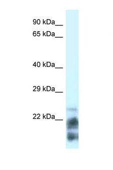 MDP-1 Antibody - MDP1 antibody Western blot of HeLa Cell lysate. Antibody concentration 1 ug/ml. This image was taken for the unconjugated form of this product. Other forms have not been tested.