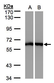 ME1 / Malate Dehydrogenase Antibody - Sample (30 ug whole cell lysate). A: A431, B: HeLa S3. 7.5% SDS PAGE. ME1 / Malate Dehydrogenase antibody diluted at 1:500