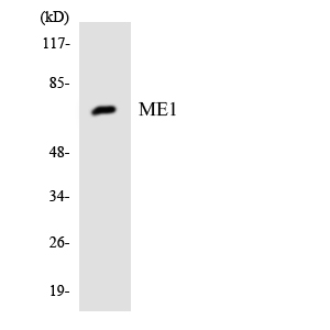 ME1 / Malate Dehydrogenase Antibody - Western blot analysis of the lysates from HeLa cells using ME1 antibody.