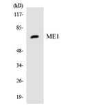 ME1 / Malate Dehydrogenase Antibody - Western blot analysis of the lysates from HeLa cells using ME1 antibody.