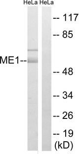 ME1 / Malate Dehydrogenase Antibody - Western blot analysis of lysates from HeLa cells, using ME1 Antibody. The lane on the right is blocked with the synthesized peptide.