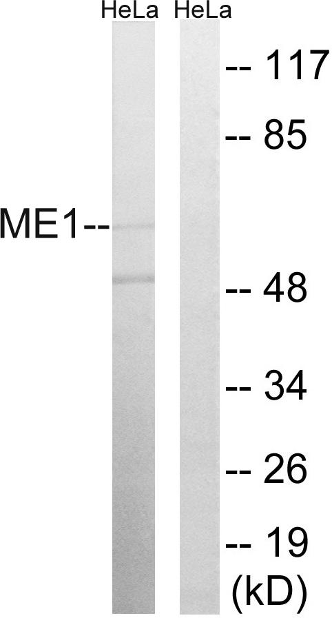 ME1 / Malate Dehydrogenase Antibody - Western blot analysis of extracts from HeLa cells, using ME1 antibody.