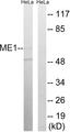 ME1 / Malate Dehydrogenase Antibody - Western blot analysis of extracts from HeLa cells, using ME1 antibody.