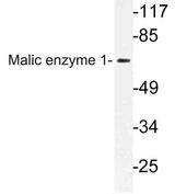 ME1 / Malate Dehydrogenase Antibody - Western blot of Malic enzyme 1 (Y500) pAb in extracts from HeLa cells.