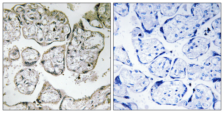 ME2 / Malate Dehydrogenase 2 Antibody - Immunohistochemistry analysis of paraffin-embedded human placenta tissue, using ME2 Antibody. The picture on the right is blocked with the synthesized peptide.