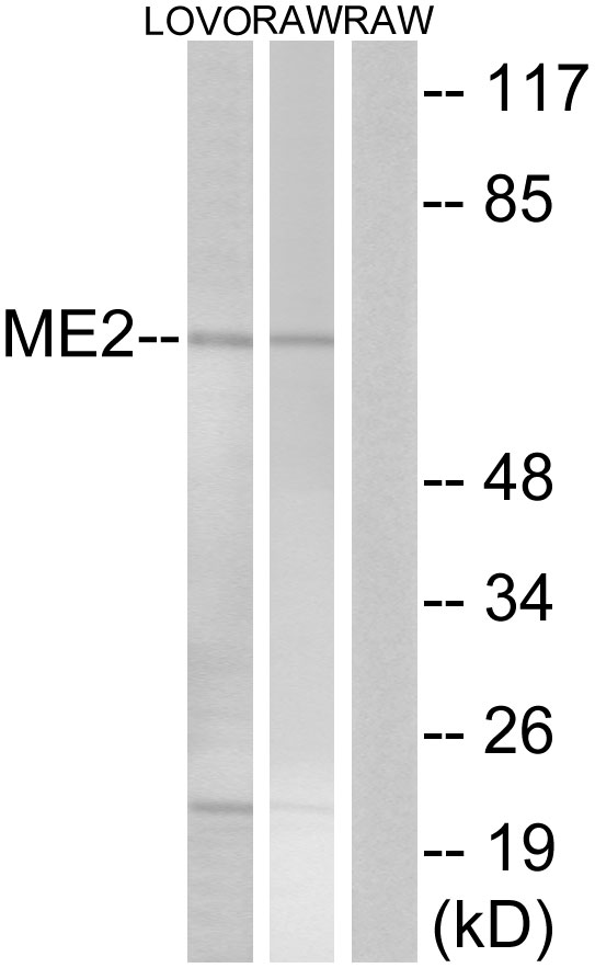ME2 / Malate Dehydrogenase 2 Antibody - Western blot analysis of lysates from RAW264.7 and LOVO cells, using ME2 Antibody. The lane on the right is blocked with the synthesized peptide.