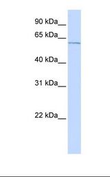 ME2 / Malate Dehydrogenase 2 Antibody - Jurkat cell lysate. Antibody concentration: 1.0 ug/ml. Gel concentration: 12%.  This image was taken for the unconjugated form of this product. Other forms have not been tested.