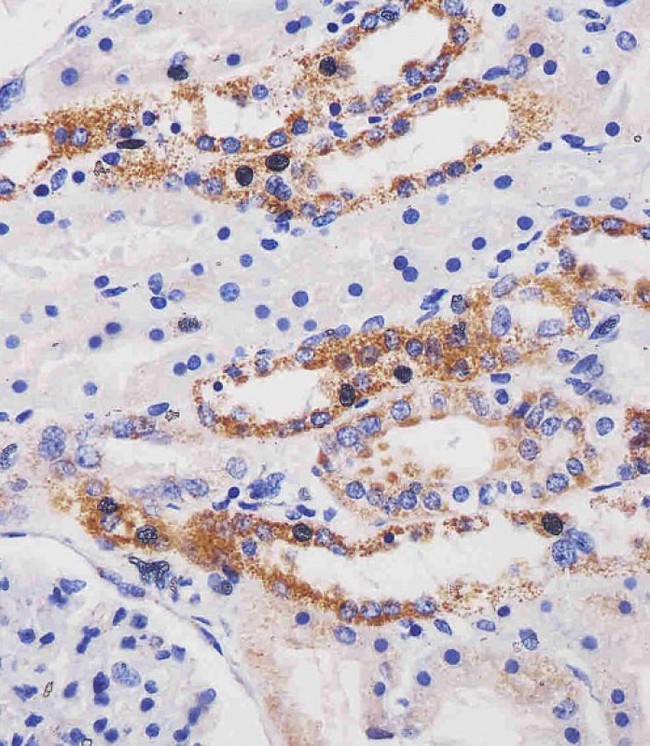 ME2 / Malate Dehydrogenase 2 Antibody - ME2 Antibody (C-term) staining ME2 in human kidney tissue sections by Immunohistochemistry (IHC-P - paraformaldehyde-fixed, paraffin-embedded sections). Tissue was fixed with formaldehyde and blocked with 3% BSA for 0. 5 hour at room temperature; antigen retrieval was by heat mediation with a citrate buffer (pH6). Samples were incubated with primary antibody (1/25) for 1 hours at 37°C. A undiluted biotinylated goat polyvalent antibody was used as the secondary antibody.