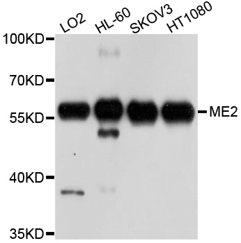 ME2 / Malate Dehydrogenase 2 Antibody - Western blot analysis of extract of various cells.